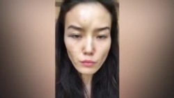 Жена казахстанского дипломата рассказала, что муж ее десять лет избивал: МИД отозвал мужчину на родину