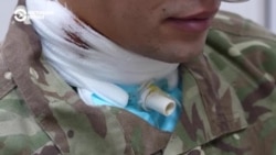 История украинского военного, пережившего пытки в российском плену