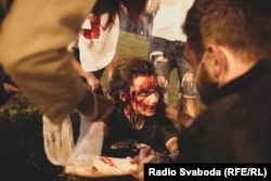 Мария Зайцева в после ранения светошумовой гранатой. 9 августа, Минск