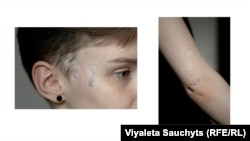 Фотографии из проекта "Шрамы протеста" фотожурналистки Виолетты Савчиц